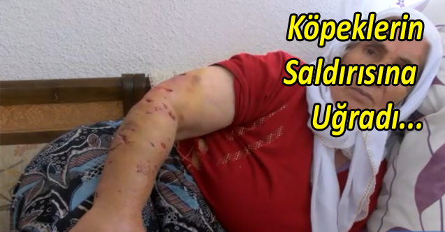  Sokak köpeğinin saldırısına uğradı