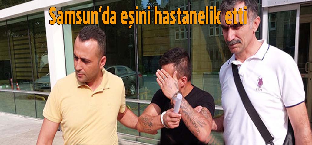  Samsun'da eşini hastanelik etti